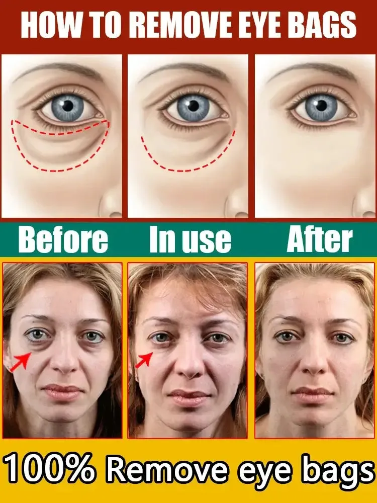 Eye Repair cream
