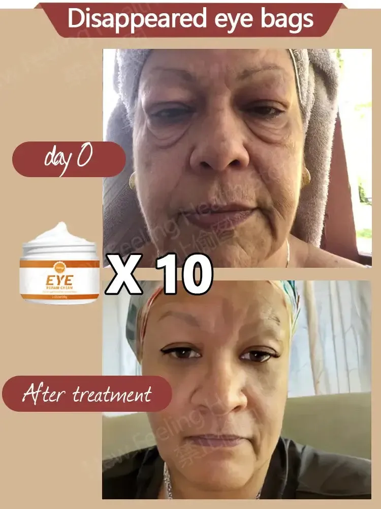 Eye Repair cream