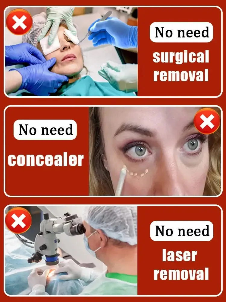 Eye Repair cream